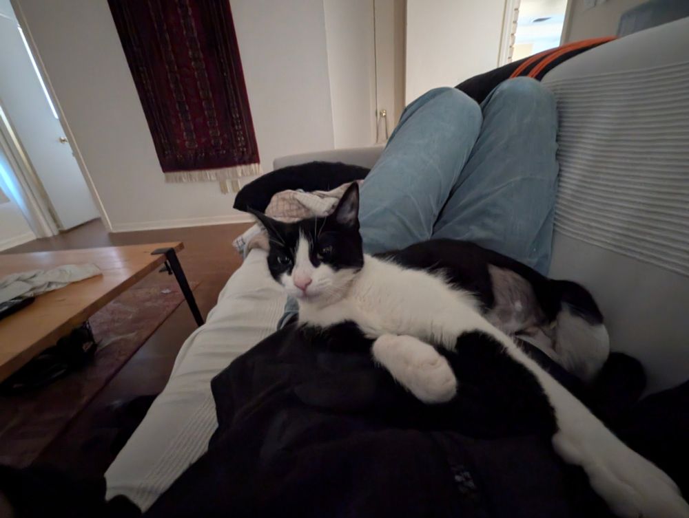 tuxedo cat with a shaved belly laying on my stomach while I lay on the couch 