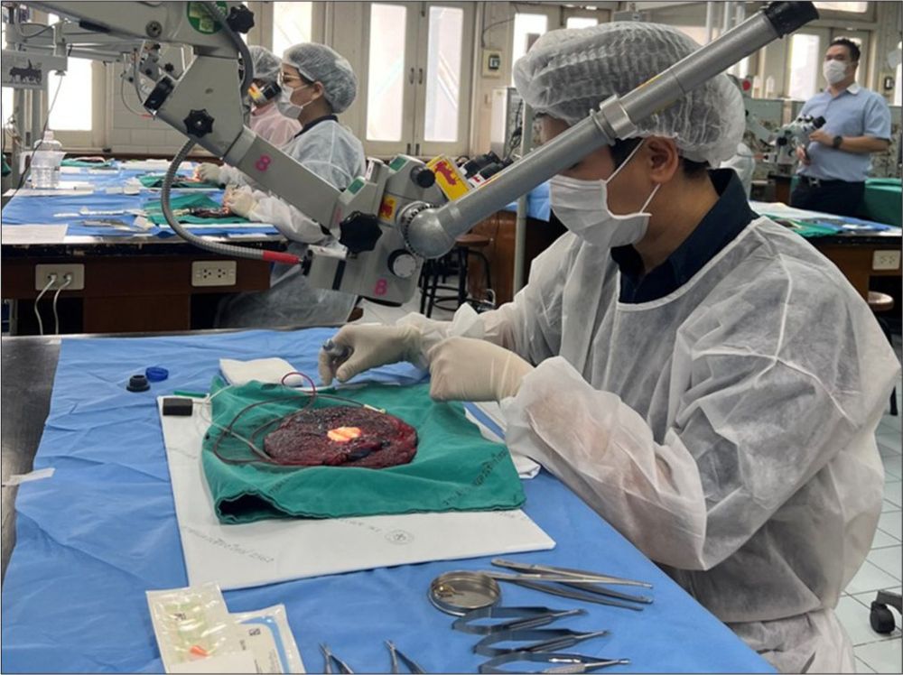 Figure 5 from the 2025 paper by Srihagulang et al., "Defrosted versus fresh human placenta models for microvascular bypass training: A comparative study in surgical simulation" (doi:
10.25259/JNRP_224_2025). The figure, which is a photograph, has the following description: Overview of the laboratory and participants performing bypass and anastomosis of the frozen placenta model.