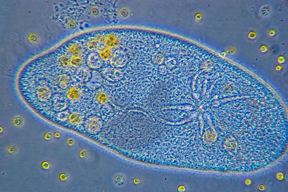 microscopic close-up of a paramecium. Image by Jasper Nance under a CC BY-NC-ND license: https://bit.ly/4eItkEp.