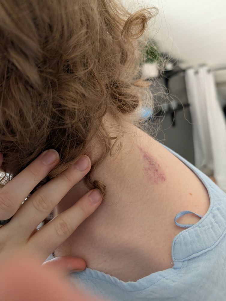 Bite marks on my puppy's neck