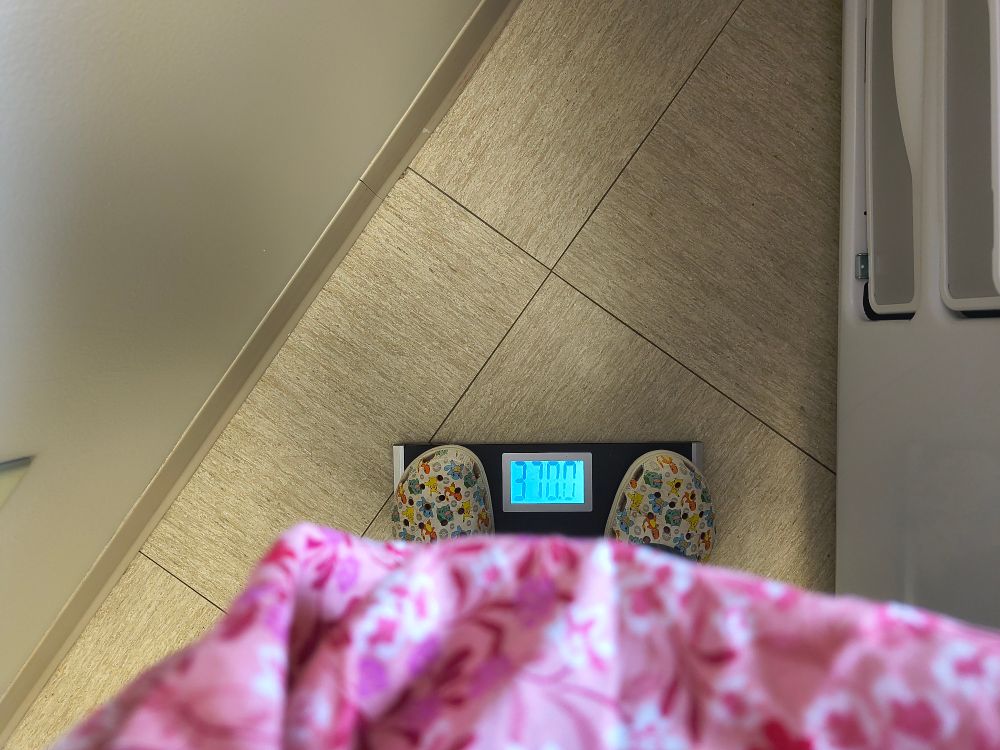 Peering over a large belly in a doctor's office to see a scale that reads 370.0 (lbs)