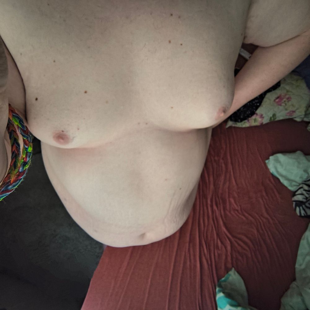 Top-down fat trans woman, speckled with freckles
