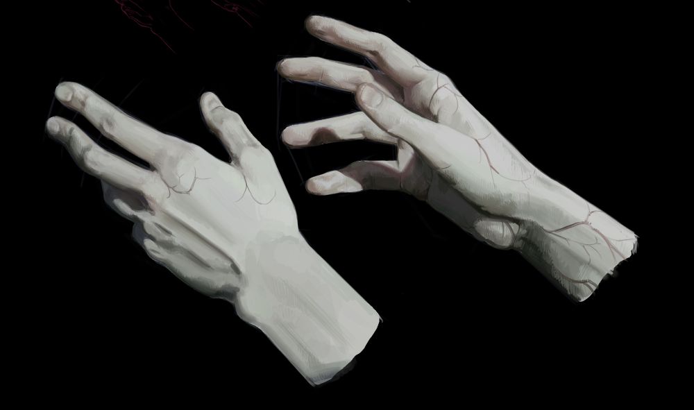 A (unfinished) painting of two hands on a black background. The skin is incredibly fair and covered in Lichtenberg figure scars, in them hidden two medical scars (one for each arm).

A study of my changeling wizard, named Galen.