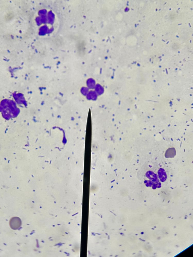 Microscope slide. There’s a background of purple granules. There are four larger cells with purple segmented chromatin. These are neutrophils. Some of them have bacteria in their cytoplasm. At the end of a pointer there’s  a neutrophil that looks a lot like a paw