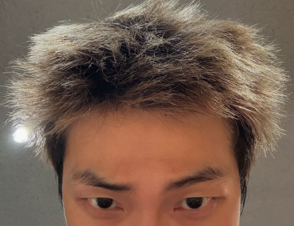 picture of the upper half of namjoon’s head showing his blond spiky hair in disarray and his brows slightly scrunched and his eyes looking down to his camera screen. he has a lovely little mole on his hairline just off center 