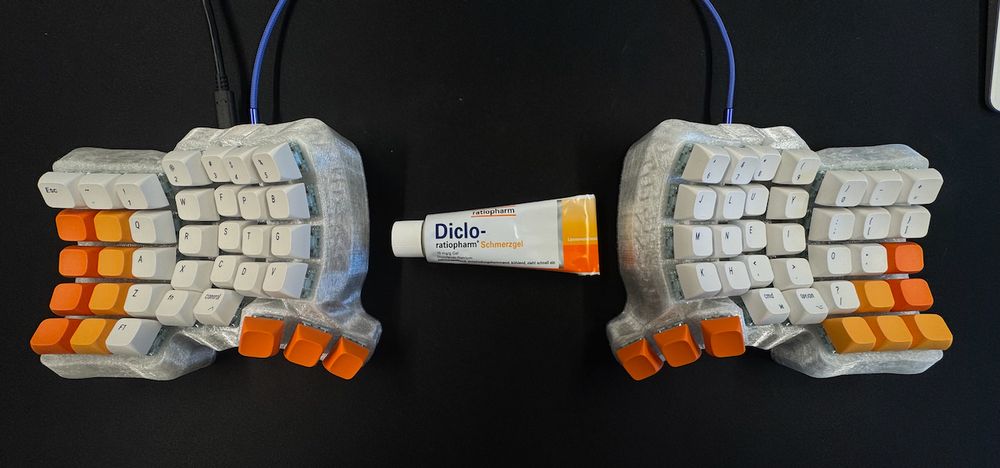 Two halves of a 3D printed ergonomic split keyboard surrounding pain relief gel.