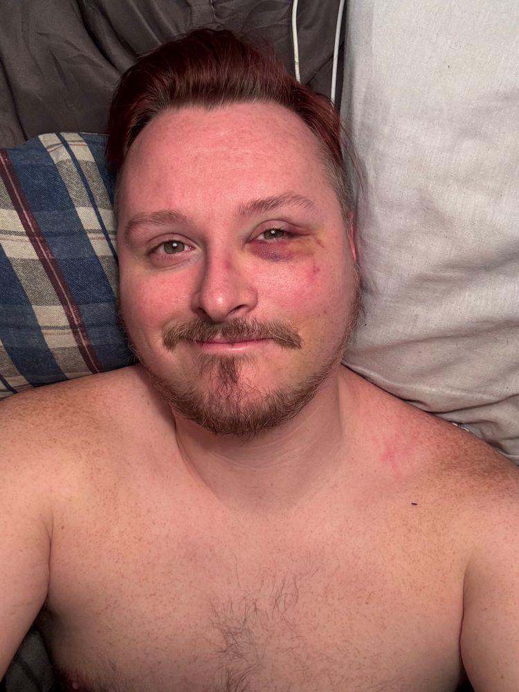 Skyler in bed. He’s doing a closed mouth smile. 