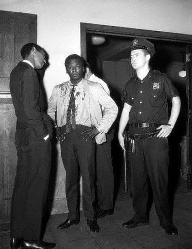 Black and white picture of a bloodied miles davis defiantly looking straight into the camerawith a look of are you getting this on his face, his hands are on his hips and his light coloured suit jacket and shirt have several bloodstains... on his left side stands a black man whose head is tilted in concern as he looks upon miles... to the right of miles davis is a white cop avoiding everybody's gaze, his right hand still on the Billy clubs

On August 25, 1959, the great Jazz trumpeter Miles Davis was beaten by New York City police officers, that’s why he’s covered in blood. Davis was finishing a two-week stint at the famous Birdland Jazz Club. 

While taking a break, Davis escorted a young white woman outside where they could smoke. A white police officer ordered him to “move on.” Davis replied, “For what? I'm performing here.” The officer decided to arrest him, a physical struggle ensued and three detectives joined in and began beating Davis in the stomach and on the head with billy clubs. A crowd of 200 people quickly appeared. Davis was subsequently acquitted of the charges of disorderly conduct and assaulting an officer. The story, complete with pictures, received wide news media coverage and served to dramatize the simmering issue of racism in the New York City Police Department.

The case dramatized the pattern of police harassment of African-Americans for behavior that is not an offense (standing on the corner smoking a cigarette) and the escalation of such incidents into the use of force by the police. 

In comparison to these modern times,
nothing has changed except the year.