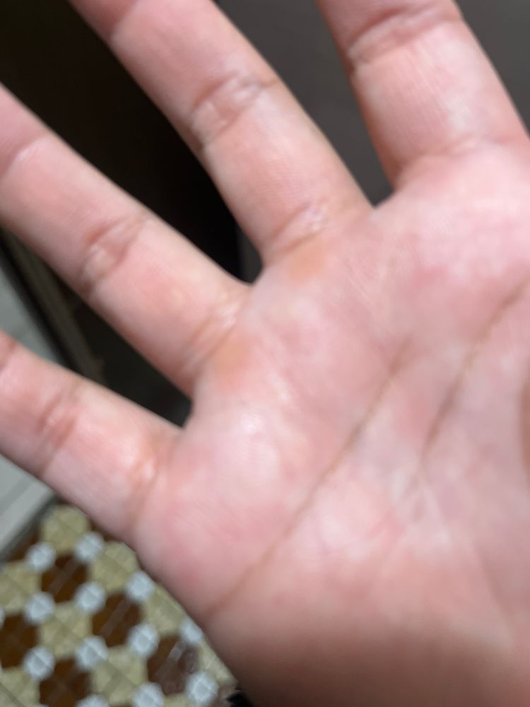 中指跟無名指的地方