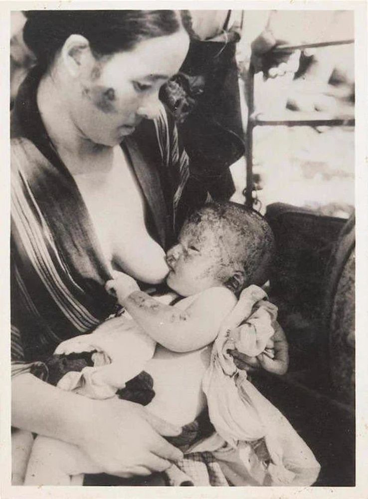 A black and white photograph by Japanese military photographer Yosuke Yamahata of an injured young woman in Nagasaki nursing her injured baby while sitting outside. The woman appears to be in shock and the baby appears to have burns on its left arm, head, and face.