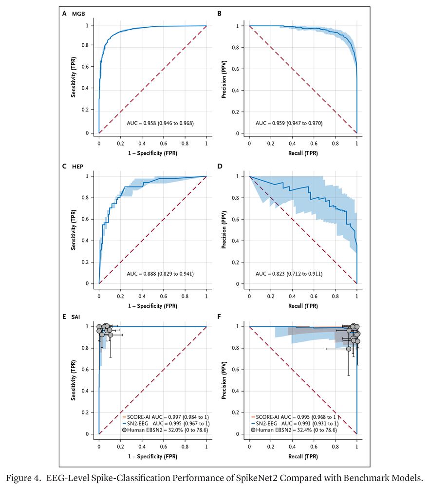 Figure 4. EEG-Level Spike-Classification Performance of SpikeNet2 Compared with Benchmark Models.