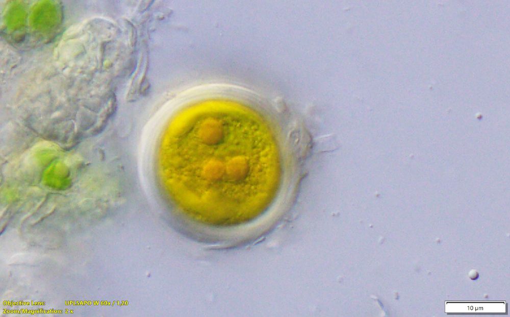 Unicellular round alga with golden colour some circle structures inside.