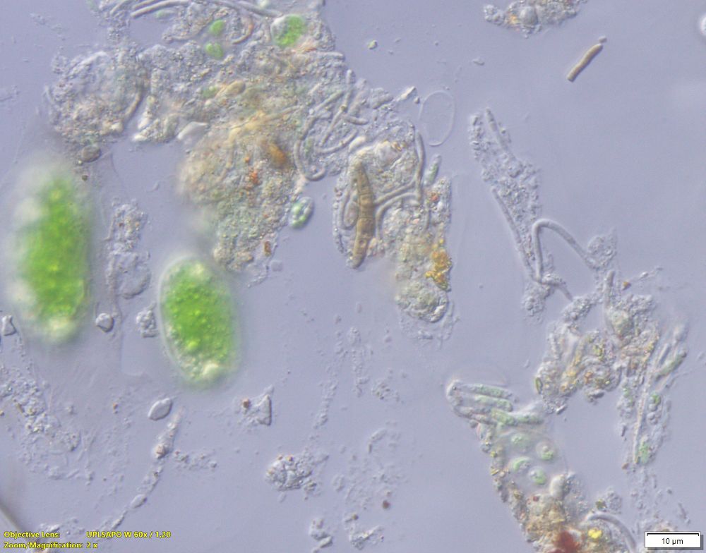 Conidia and some spores