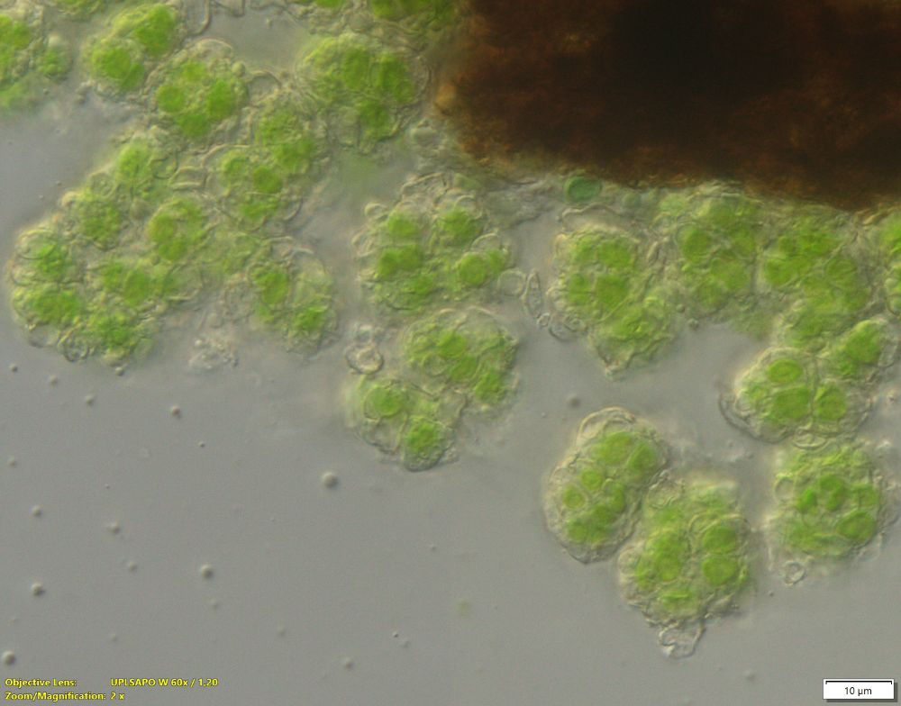 Lichen consisting of small packets of algae covered in hyphae (high power micrograph)