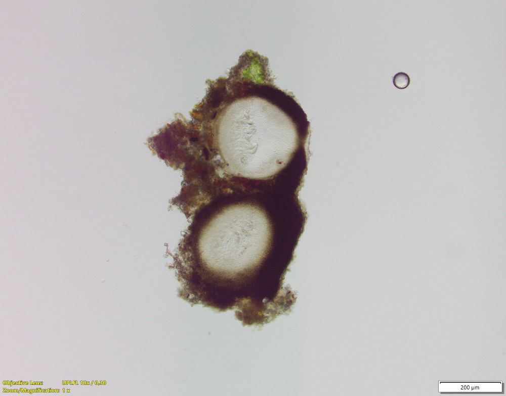Section through 2 perithecia.