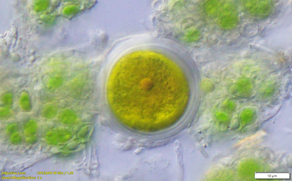 Unicellular round alga with golden colour some circle structures inside.