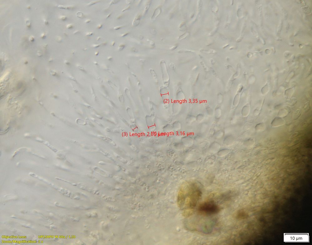 Periphysoids with measurements.