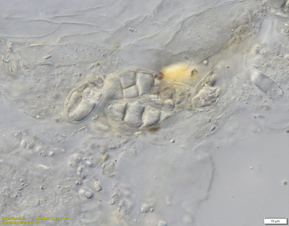 Spores in K