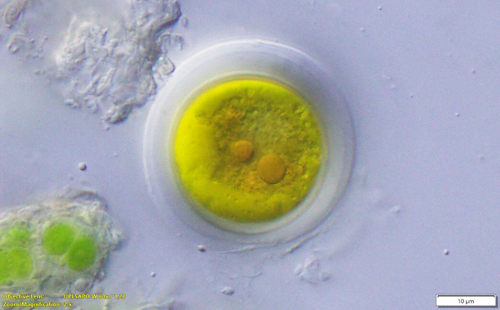 Unicellular round alga with golden colour some circle structures inside.