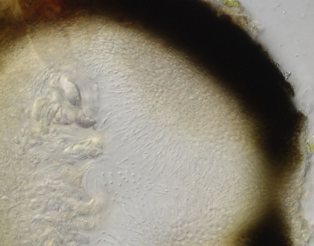 Perithecium section with pore and periphyses/periphysoids. 