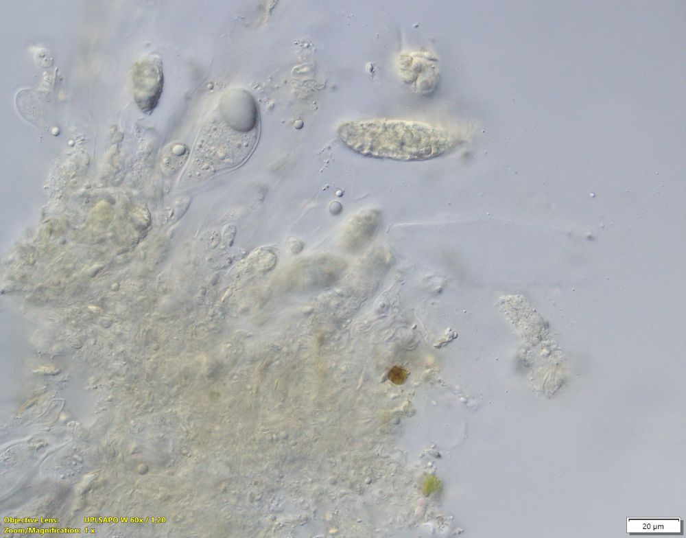 Spores in water. Some are large muriform, some submuriform.