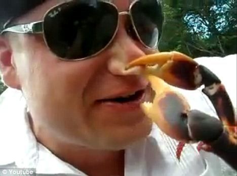 Picture of a crab pinching the nose of a man using it's claw