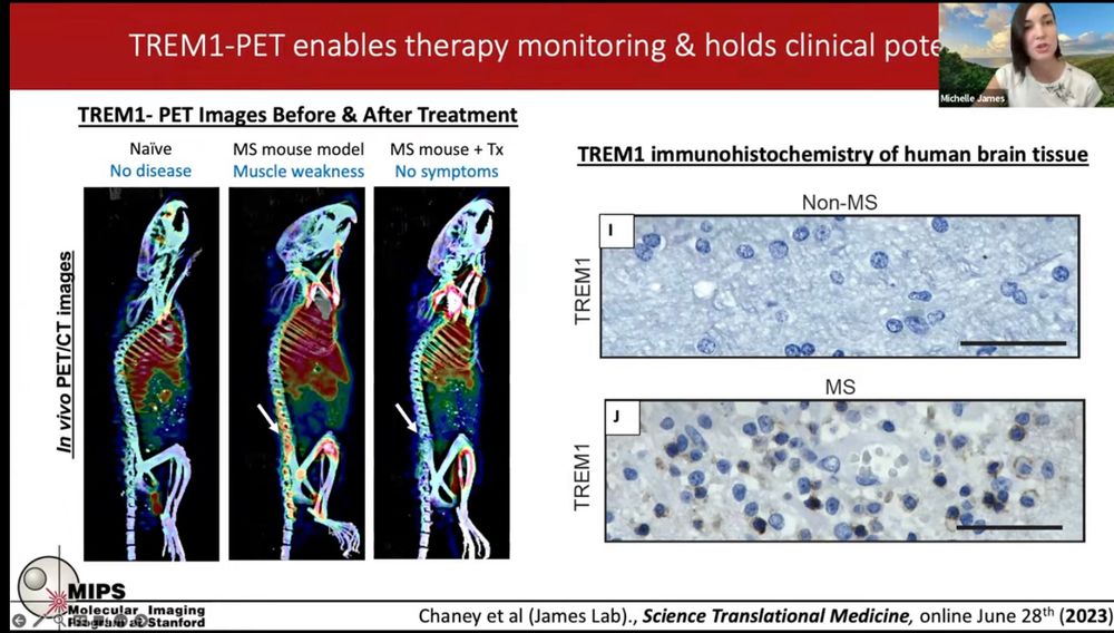 In der roten Überschrift steht: 
TREM1-PET erlaubt Therapie Kontrolle 
Darunter Mäuse PET Scans ohne Krankheit, mit multipler Sklerose typischen Entzündungen im Rückenmark und ohne Entzündung nach Medikation, daneben Bilder von Proben von menschlichem Gehirn TREM1 ist im Gesunden Gehirn kaum vorhanden, während es in einer Gehirnprobe eines MS Kranken sehr viele Anhäufungen davon gibt. 