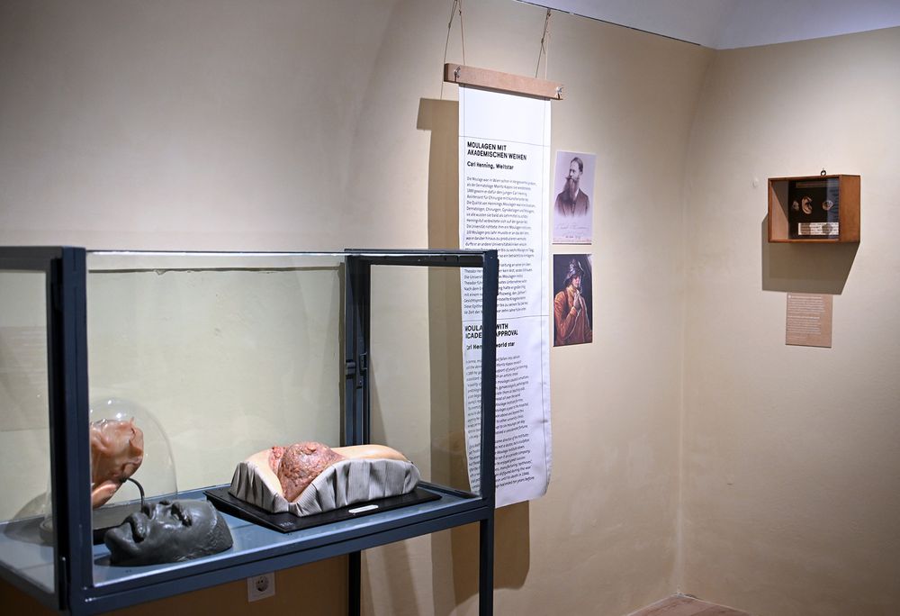 Ausstellung im Narrenturm: Die Kunst der Moulage - verewigte Krankheitsbilder (c) NHM Wien, Chloe Potter