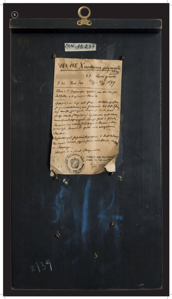 Ausstellung im Narrenturm: Die Kunst der Moulage - verewigte Krankheitsbilder (c) NHM Wien, Chloe Potter