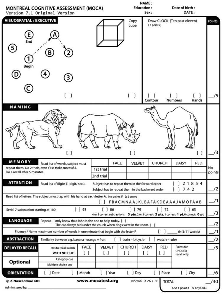 Image of the Montreal cognitive assessment