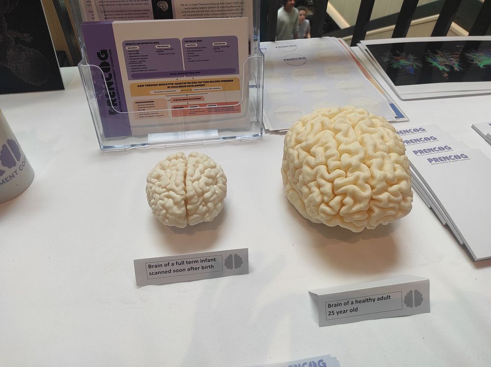 Photo of 3D printed brains of different sizes