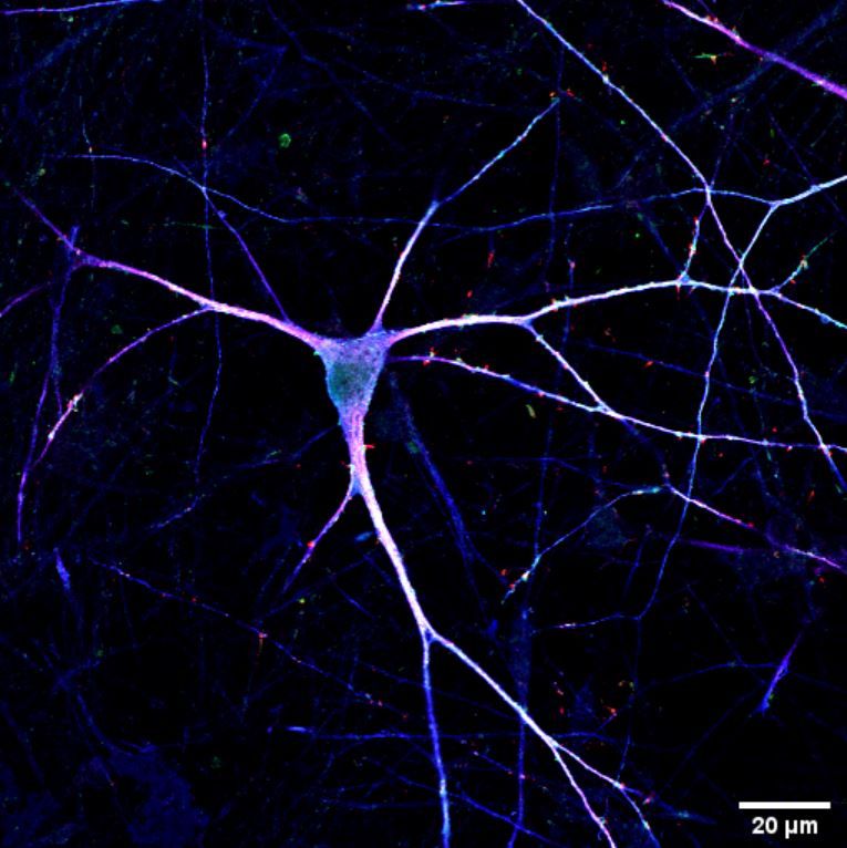 Microscopic image of a neuron