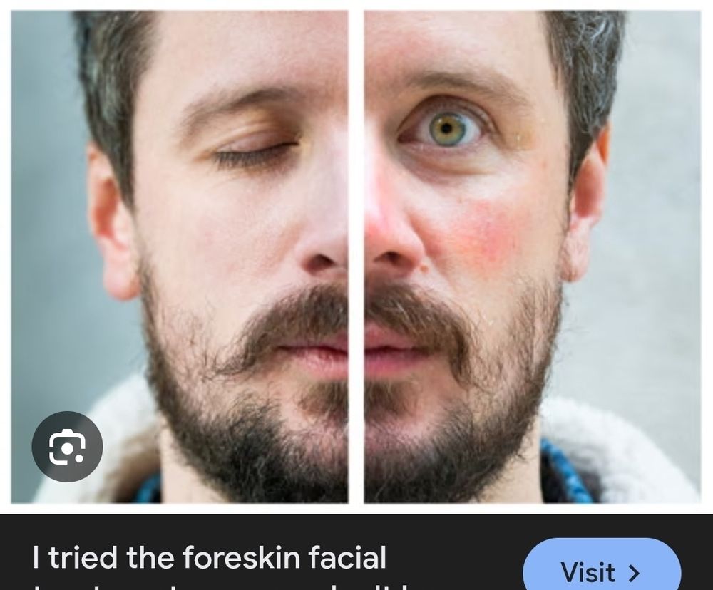 Before: autism 
After: nawtism