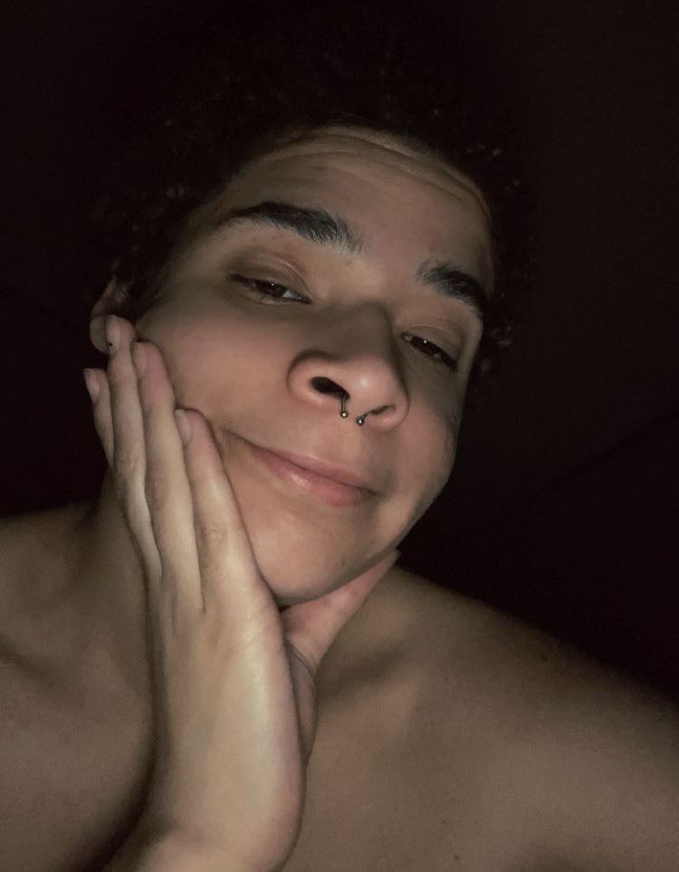 Above my chest Image of me shirtless holding my cheek with my hand. 
