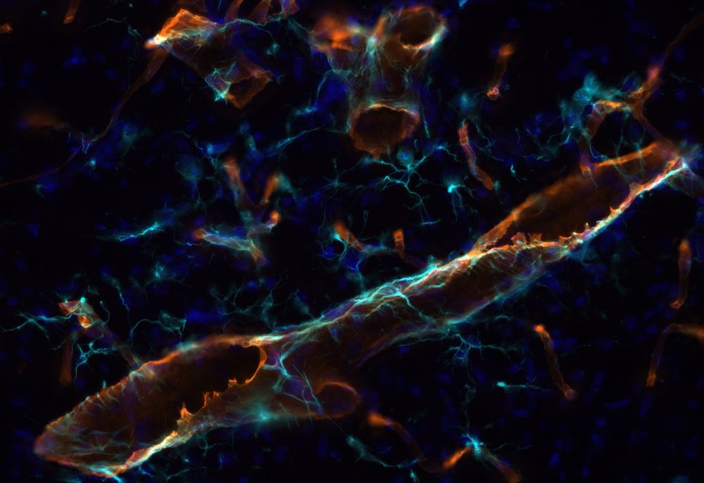 Immunostaining of a mouse brain blood vessel.