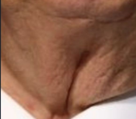 Trump’s neck pussy