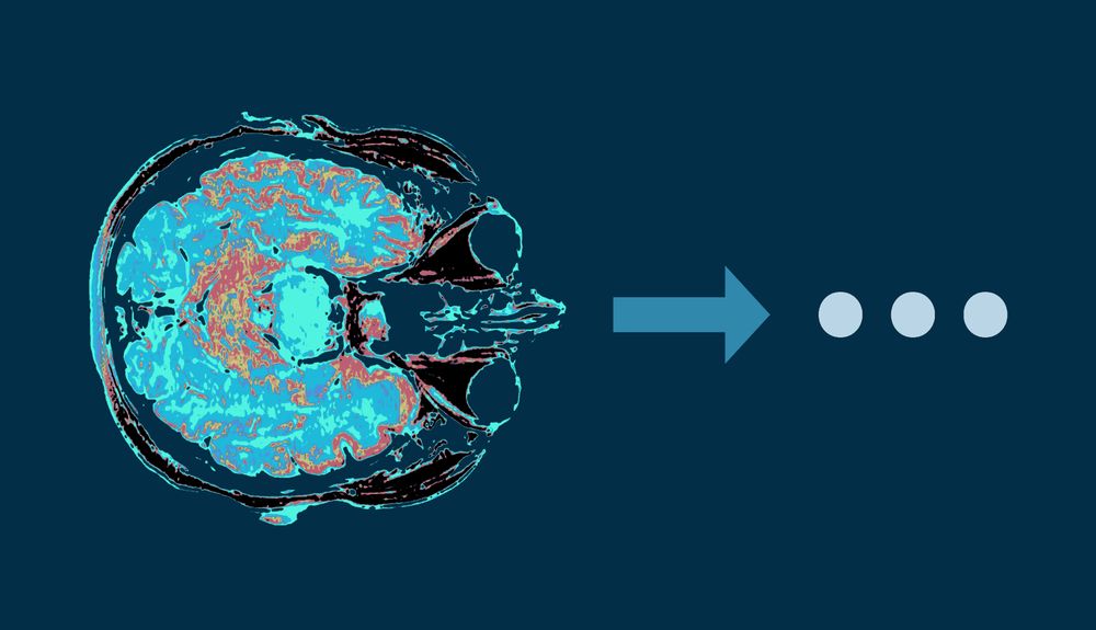 Image is a brain MRI seen from top down, followed by an arrow pointing right and three dots.  Original image this is based on is actually Stephen Wolfram's brain