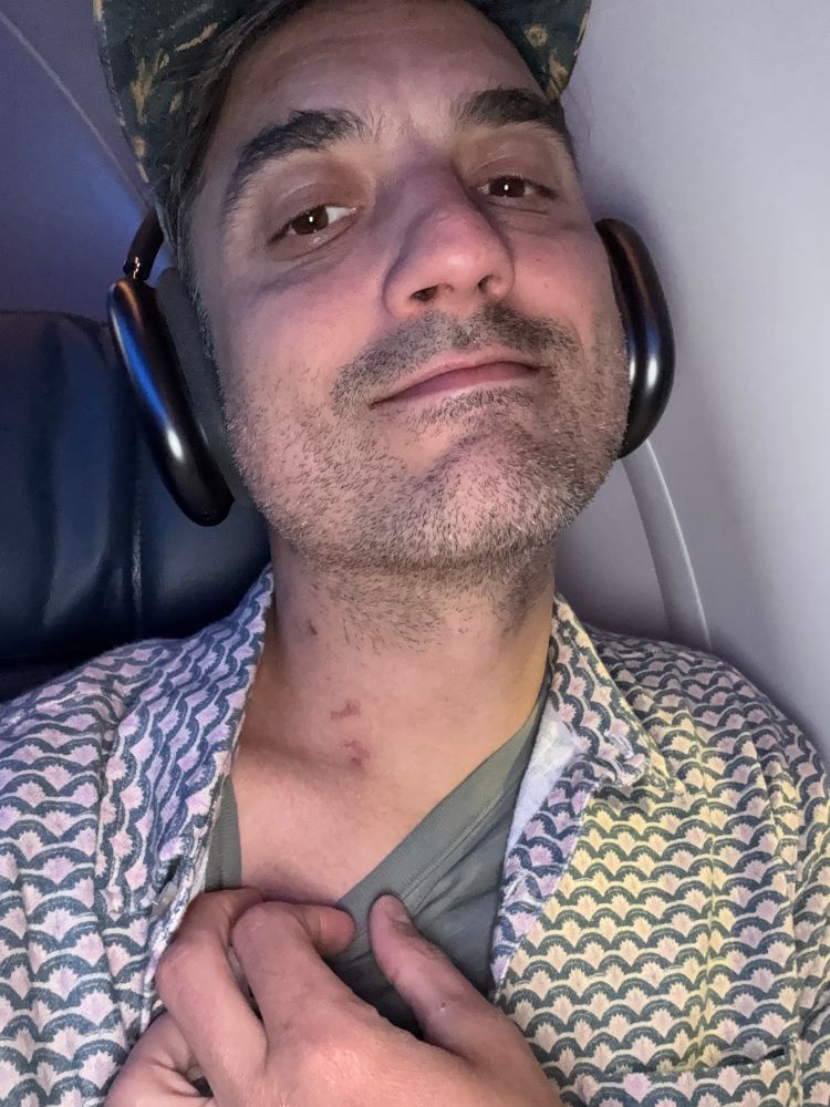 Hickeys or central lines?