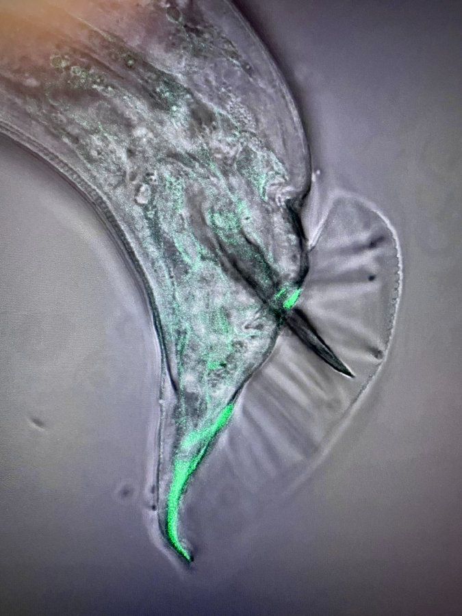 Microscopic image of C. elegans, with fluorescent green labeling certain proteins