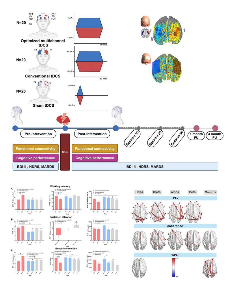 Efficacy of optimized multichannel vs conventional tDCS for major depression treatment: A randomized controlled trial. Starstim. Neuroelectrics