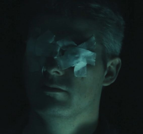 Man with ping pong balls fully taped over both eyes