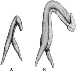 Medical illustration of two organs. On the left is an organ with two "legs" at the bottom, a long body, and a shaft at the top, bent. On the right is an organ which is taller than the one on the left, with "legs" at the bottom, a longer body, and a longer shaft at the top, bent, with a prominent glans. 

From V Puppo and G Puppo, "Anatomy of Sex: Revision of the New Anatomical Terms Used for the Clitoris and the Female Orgasm by Sexologists", 2015.