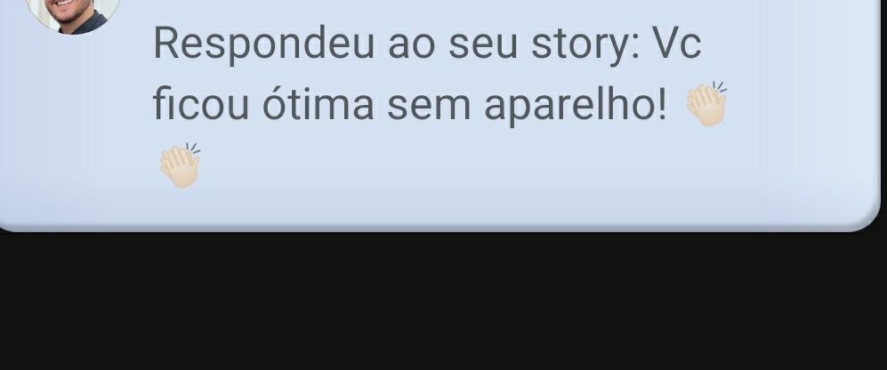 Notificação do Instagram. A resposta do story diz: Você ficou ótima sem aparelho! 👏👏