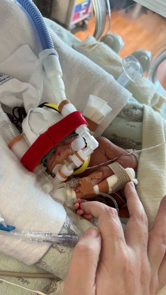 Photo of a tiny baby in an incubator wearing a NIPPV helmet. His tiny fingers cup my finger tip.