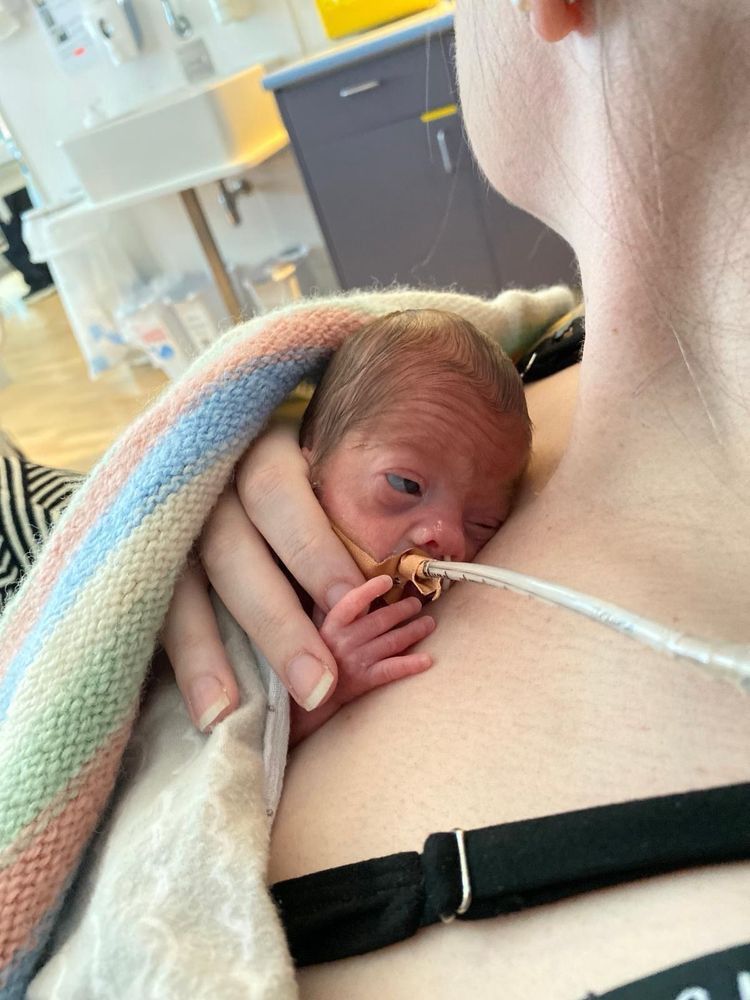 A small premature baby has cuddles on their parent’s chest. Their tiny hand holds their parent’s finger.