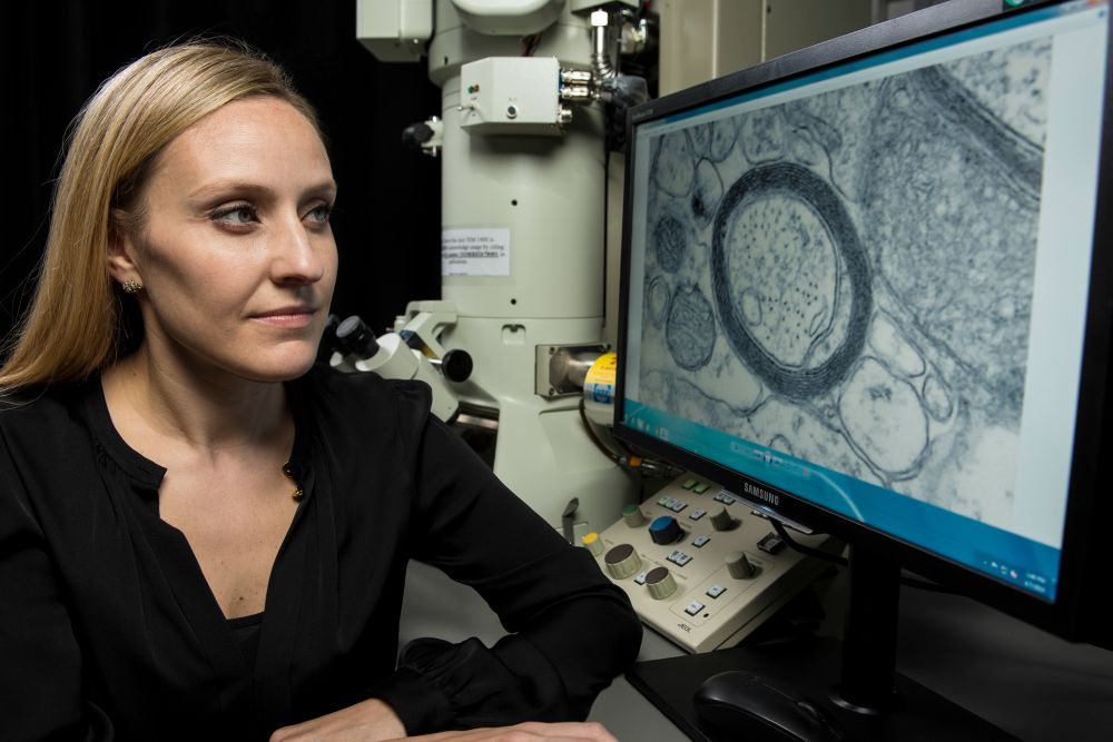 Erin Gibson examines an electron microscope image of rings of myelin surrounding an axon. 