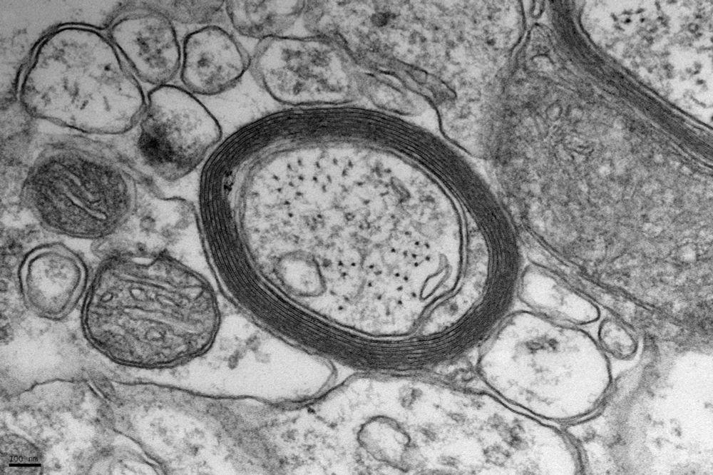 A dark ring of myelin in a black and white image of a cell. Image courtesy of Michelle Monje.