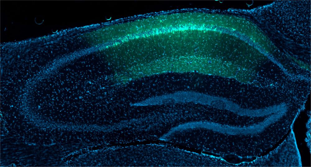 A section of the mouse hippocampus illustrates where cells were genetically engineered to fluoresce when active using GCaMP, a genetically encoded calcium indicator commonly used to image brain activity. Image credit: Giocomo Lab