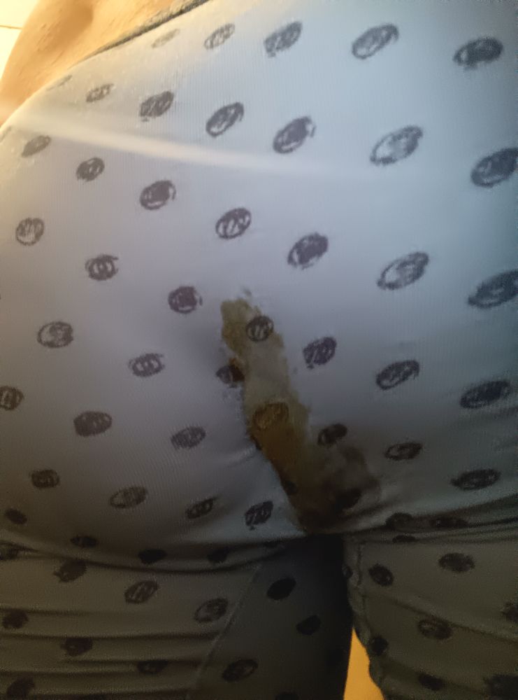 pic of me in some soiled boxers, tiny mess stain and very minimal bulging