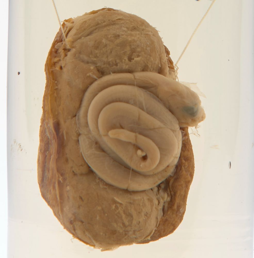 A close-up view of a preserved rattlesnake embryo
